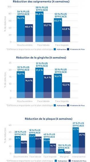 Jet Dentaire Waterpik® : Significativement Plus Efficace Que Sonicare® AirFloss Pro Pour Améliorer La Santé Gingivale